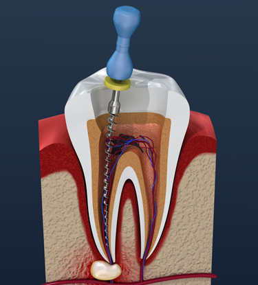 Treatment - Six Gables : Dental Practice